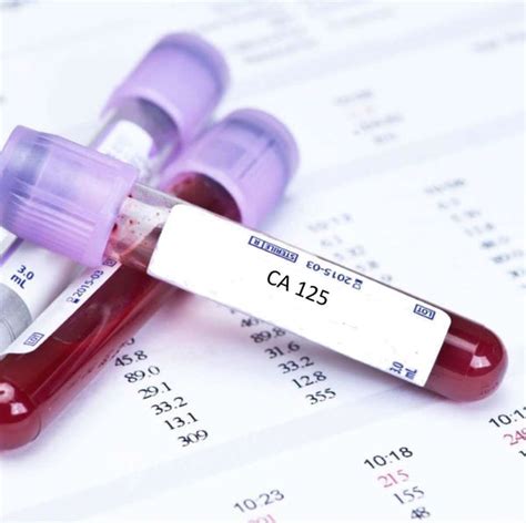 ca125 blood test bottle|ca125 lab tests online.